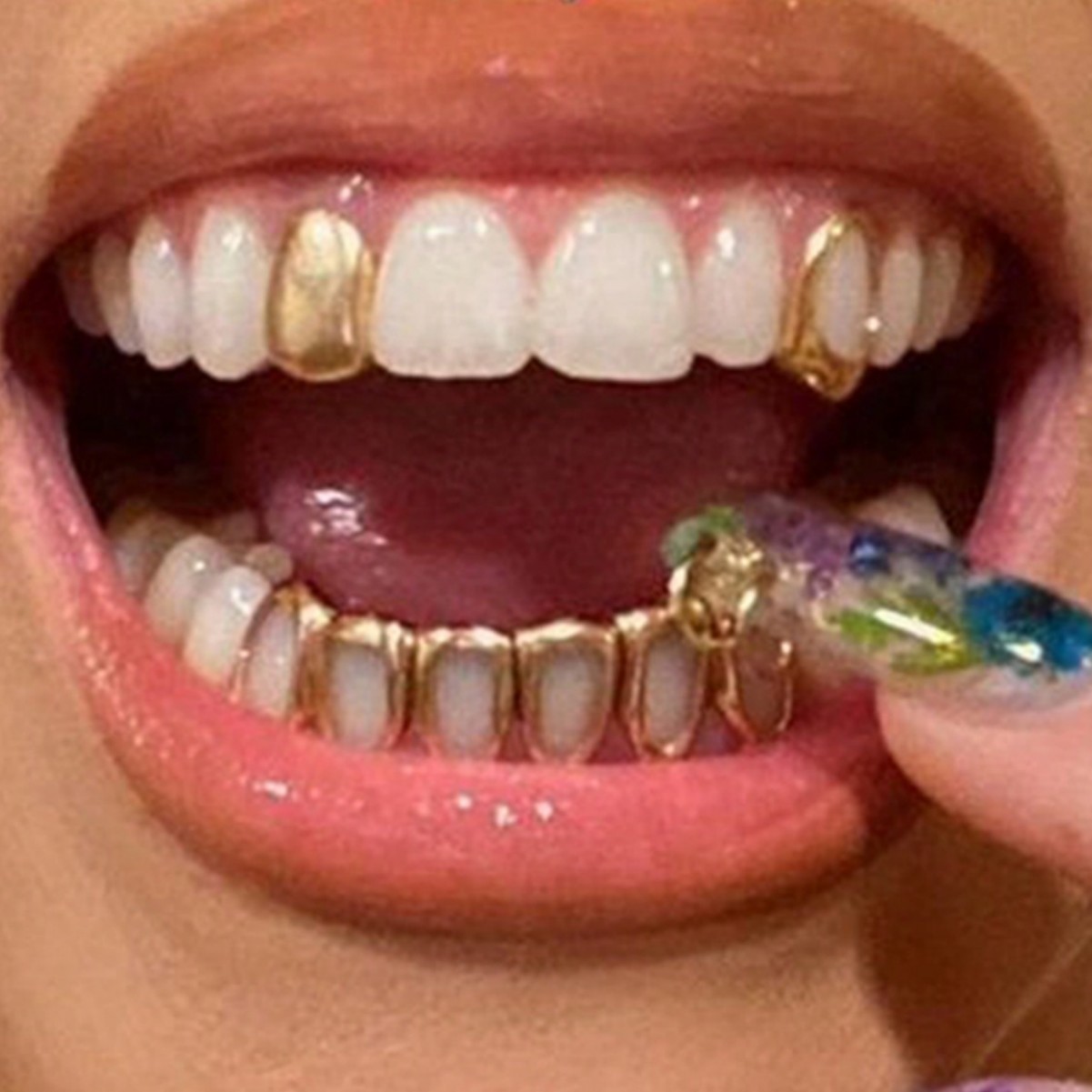 Body Jewelry Hot - ฟันปลอมฮิปฮอปแบบแบน 6 รู ลดราคาพิเศษ ชุด 3